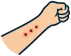 Bites when you wake up